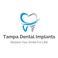 Tampa Dental Implants Logo