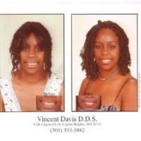 Vincent H. Davis DDS Logo