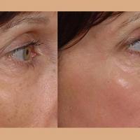 Arkansas Laser & Skin Care Logo