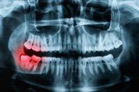 Rockwell Oral and Facial Surgery Logo