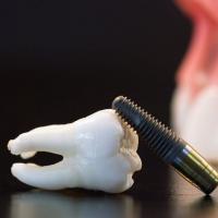 First Impressions Dental Lab Logo