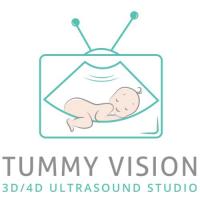 Tummy Vision 3D/4D Ultrasound & Gender Reveal Logo