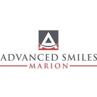 Advanced Smiles Marion Logo