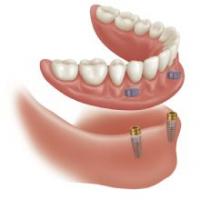 Implant Denture and Dental Center logo