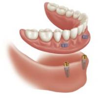 Implant Denture and Dental Center Logo