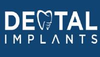 Dental Implants of Mobile Logo