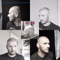 Pacific Northwest Scalp Micropigmentation Logo
