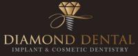 Diamond Dental Logo