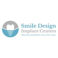 Smile Design Implant Center logo