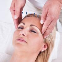 Sunyo Acupuncture Center Logo