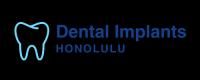 Dental Implants Honolulu Logo